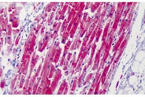 Human Heart: Formalin-Fixed, Paraffin-Embedded (FFPE) (CAPN1 antibody)