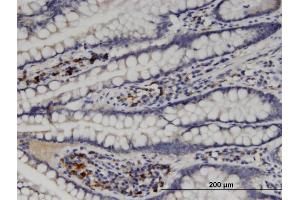 Immunoperoxidase of monoclonal antibody to MGAT5 on formalin-fixed paraffin-embedded human small Intestine. (MGAT5 antibody  (AA 642-739))