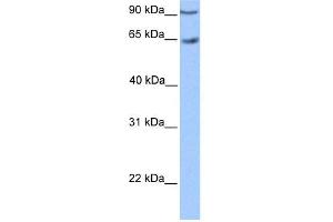 WB Suggested Anti-ZNF449 Antibody Titration:  0. (ZNF449 antibody  (C-Term))