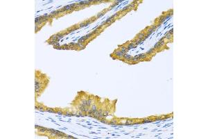Immunohistochemistry of paraffin-embedded human prostate using BTD antibody (ABIN6127510, ABIN6137680, ABIN6137682 and ABIN6221882) at dilution of 1:100 (40x lens). (BTD antibody  (AA 284-543))