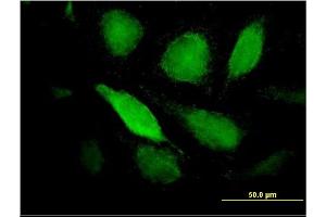 Immunofluorescence of monoclonal antibody to PTX3 on HeLa cell.