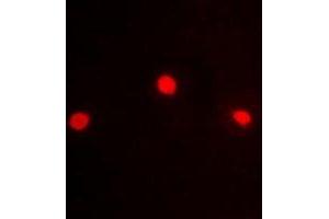 Immunofluorescent analysis of ZFP95 staining in HeLa cells. (ZKSCAN5 antibody)