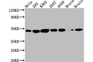 Western Blot Positive WB detected in: Hela whole cell lysate, 293 whole cell lysate, K562 whole cell lysate, 293T whole cell lysate, A549 whole cell lysate, Rat Brain whole cell lysate, Mouse Brain whole cell lysate All lanes: NUDC antibody at 1:1000 Secondary Goat polyclonal to rabbit IgG at 1/50000 dilution Predicted band size: 39 kDa Observed band size: 45 kDa (Recombinant NUDC antibody)