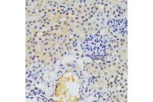 Immunohistochemistry of paraffin-embedded mouse kidney using HNRNPA1 Antibody (ABIN5975570) at dilution of 1/100 (40x lens). (HNRNPA1 antibody)