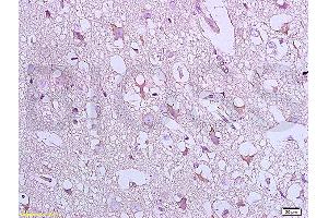 Formalin-fixed and paraffin embedded:  rat brain tissue labeled with Anti-Bax Polyclonal Antibody, unconjugated  (ABIN725390)  at 1: 800 followed by incubation with conjugated secondary antibody and DAB staining (BAX antibody  (AA 84-175))