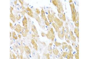 Immunohistochemistry of paraffin-embedded Rat heart using CTGF Polyclonal Antibody at dilution of 1:100 (40x lens). (CTGF antibody)