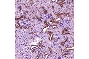 IHC testing of FFPE rat kidney with p65 antibody at 2ug/ml. (NF-kB p65 antibody  (AA 99-551))