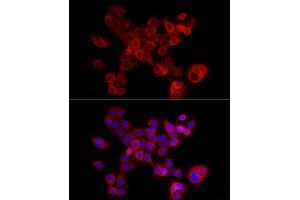 Immunofluorescence (IF) image for anti-Fatty Acid Binding Protein 5 (Psoriasis-Associated) (FABP5) (AA 1-135) antibody (ABIN6140422)