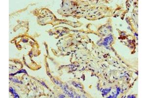 Immunohistochemistry of paraffin-embedded human placenta tissue using ABIN7144073 at dilution of 1:100 (ANAPC5 antibody  (AA 1-250))