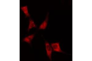 ABIN6275060 staining  Hela cells by IF/ICC. (DHODH antibody  (Internal Region))