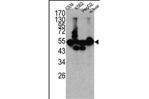 Western blot analysis of CPN1 antibody (N-term) (ABIN391509 and ABIN2841471) in K562, CEM, HEpG2 cell line lysates and mouse liver tissue lysates (35 μg/lane). (CPN1 antibody  (N-Term))