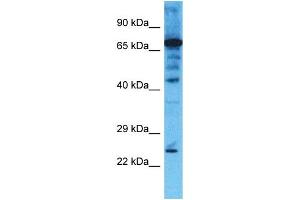 Host: Rabbit  Target Name: CHMP4B  Sample Tissue: Jurkat Whole Cell lysates  Antibody Dilution: 1. (CHMP4B antibody  (Middle Region))