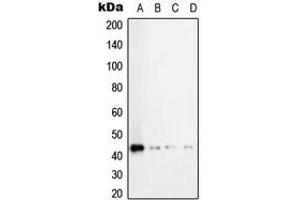 Western blot analysis of TGF beta 1 expression in HeLa (A), MCF7 (B), SP2/0 (C), H9C2 (D) whole cell lysates.