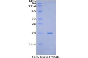 SDS-PAGE analysis of Mouse Bcl2L2 Protein. (BCL2L2 Protein)
