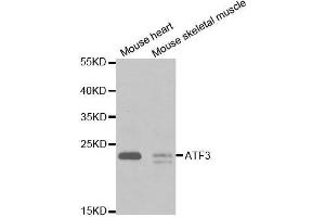 Western blot analysis of extracts of various cell lines, using ATF3 antibody. (ATF3 antibody  (AA 1-181))