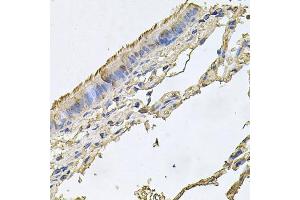 Immunohistochemistry of paraffin-embedded human trachea using FABP12 antibody. (FABP12 antibody)