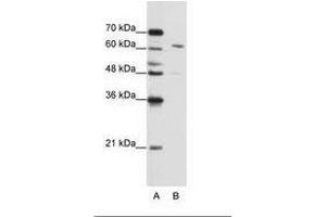 Image no. 2 for anti-Cleavage and Polyadenylation Specific Factor 6, 68kDa (CPSF6) (AA 261-310) antibody (ABIN202751) (CPSF6 antibody  (AA 261-310))
