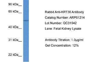Western Blotting (WB) image for anti-Keratin 36 (KRT36) (N-Term) antibody (ABIN2788722) (Keratin 36 antibody  (N-Term))