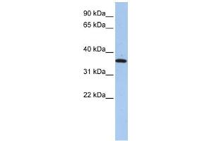 FAM84A antibody used at 1 ug/ml to detect target protein.