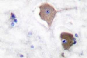 Image no. 1 for anti-Cadherin 1, Type 1, E-Cadherin (Epithelial) (CDH1) (Arg3) antibody (ABIN265314) (E-cadherin antibody  (Arg3))