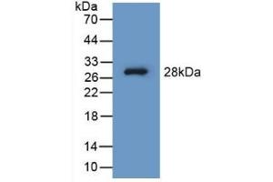 Detection of Recombinant PAH, Human using Polyclonal Antibody to Phenylalanine Hydroxylase (PAH) (Phenylalanine Hydroxylase antibody  (AA 1-226))