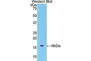 Detection of Recombinant CDK1, Mouse using Polyclonal Antibody to Cyclin Dependent Kinase 1 (CDK1) (CDK1 antibody  (AA 59-181))