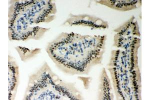 Anti- PKC epsilon Picoband antibody, IHC(P) IHC(P): Mouse Intestine Tissue (PKC epsilon antibody  (AA 53-236))