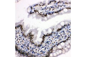 Anti-HDAC3 antibody,  IHC(P) IHC(P): Rat Intestine Tissue (HDAC3 antibody  (C-Term))