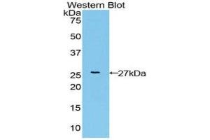 Western Blotting (WB) image for anti-Fibroblast Growth Factor Receptor-Like 1 (FGFRL1) (AA 168-378) antibody (ABIN3202407) (FGFRL1 antibody  (AA 168-378))