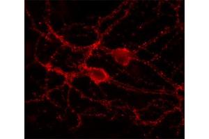 Indirect immunolabeling of cultured rat hippocampus neurons (dilution 1 : 500). (DNAJC5 antibody  (C-Term))