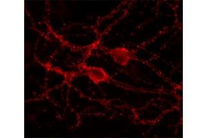 Indirect immunolabeling of cultured rat hippocampus neurons (dilution 1 : 500). (DNAJC5 antibody  (C-Term))