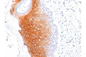 Formalin-fixed, paraffin-embedded human Skin stained with Cytokeratin 1 Mouse Monoclonal Antibody (LHK1). (Cytokeratin 1 antibody  (C-Term))