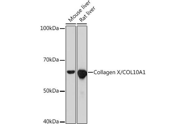 COL10A1 antibody