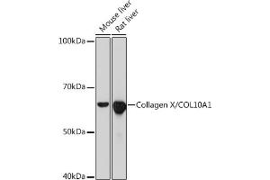 Western blot analysis of extracts of various cell lines, using Collagen X/COL10 Rabbit mAb (1645) at 1:1000 dilution. (COL10A1 antibody)
