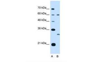 Image no. 2 for anti-Tetraspanin 32 (TSPAN32) (AA 101-150) antibody (ABIN321130) (TSPAN32 antibody  (AA 101-150))