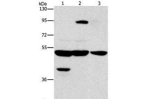 Western Blot analysis of Human bladder carcinoma tissue and A172 cell, Human brain malignant glioma tissue using STK4 Polyclonal Antibody at dilution of 1:1000 (STK4 antibody)