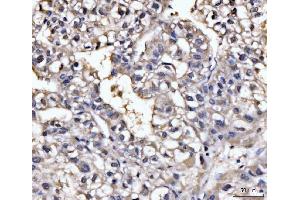 IHC analysis of GHITM using anti-GHITM antibody (ABIN7599294). (GHITM antibody  (AA 1-345))