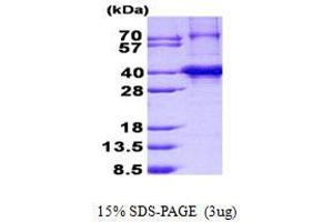 TNRC5 Protein (His tag)