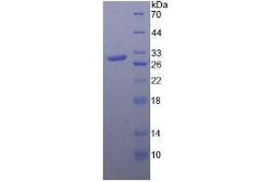 SDS-PAGE analysis of Rat Toll Like Receptor 4 Protein.