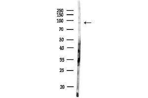 Western blot analysis of lysates from MDA-MB-231 cells(heat-shock,45 min treatment), using RNF19A Antibody at 1/1000 dilution.