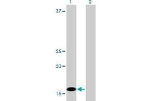 Western Blot analysis of C1D expression in transfected 293T cell line by C1D monoclonal antibody (M03A), clone 6H2. (C1D antibody  (AA 1-141))