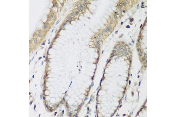 METTL7A antibody  (AA 30-244)