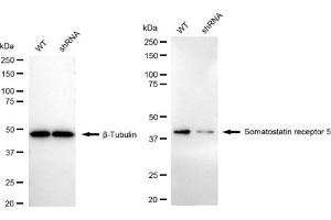 Western blotting analysis using Somatostatin receptor 5 antibody (ABIN7800403). (Recombinant SSTR5 antibody)