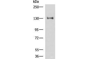 Western blot analysis of Hela cell lysate using PRPF40A Polyclonal Antibody at dilution of 1:800 (PRPF40A antibody)