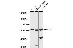 Western blot analysis of extracts of various cell lines, using MG antibody (ABIN6131880, ABIN6143811, ABIN6143812 and ABIN6224904) at 1:1000 dilution. (MGAT2 antibody  (AA 178-447))