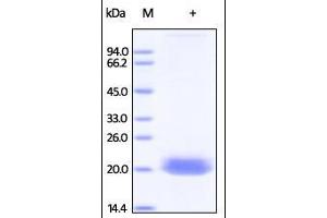 Human Ephrin-A4, His Tag on SDS-PAGE under reducing (R) condition. (EFNA4 Protein (AA 26-171) (His tag))
