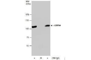Immunoprecipitation (IP) image for anti-Heat Shock Protein 90kDa beta (Grp94), Member 1 (HSP90B1) (Center) antibody (ABIN2855578)