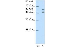 WB Suggested Anti-ZNF682 Antibody Titration:  2. (ZNF682 antibody  (N-Term))