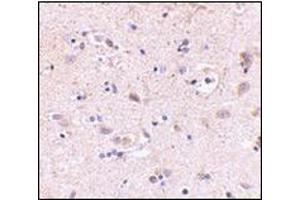 Immunohistochemistry of SATB2 in human brain with this product at 5 μg/ml. (SATB2 antibody  (C-Term))