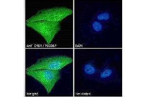 ABIN184711 Immunofluorescence analysis of paraformaldehyde fixed U251 cells, permeabilized with 0. (CYTIP antibody  (N-Term))